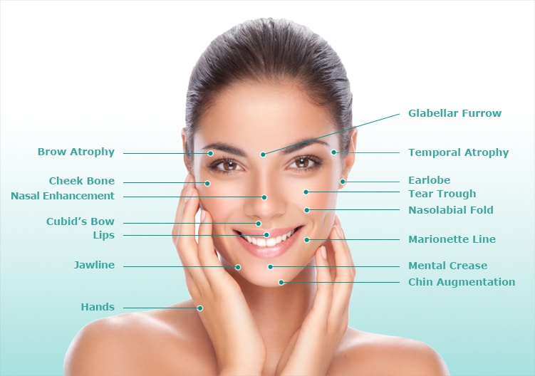 image of a female face labelling anatomy of the face for liquid facelift procedure, New York, NY