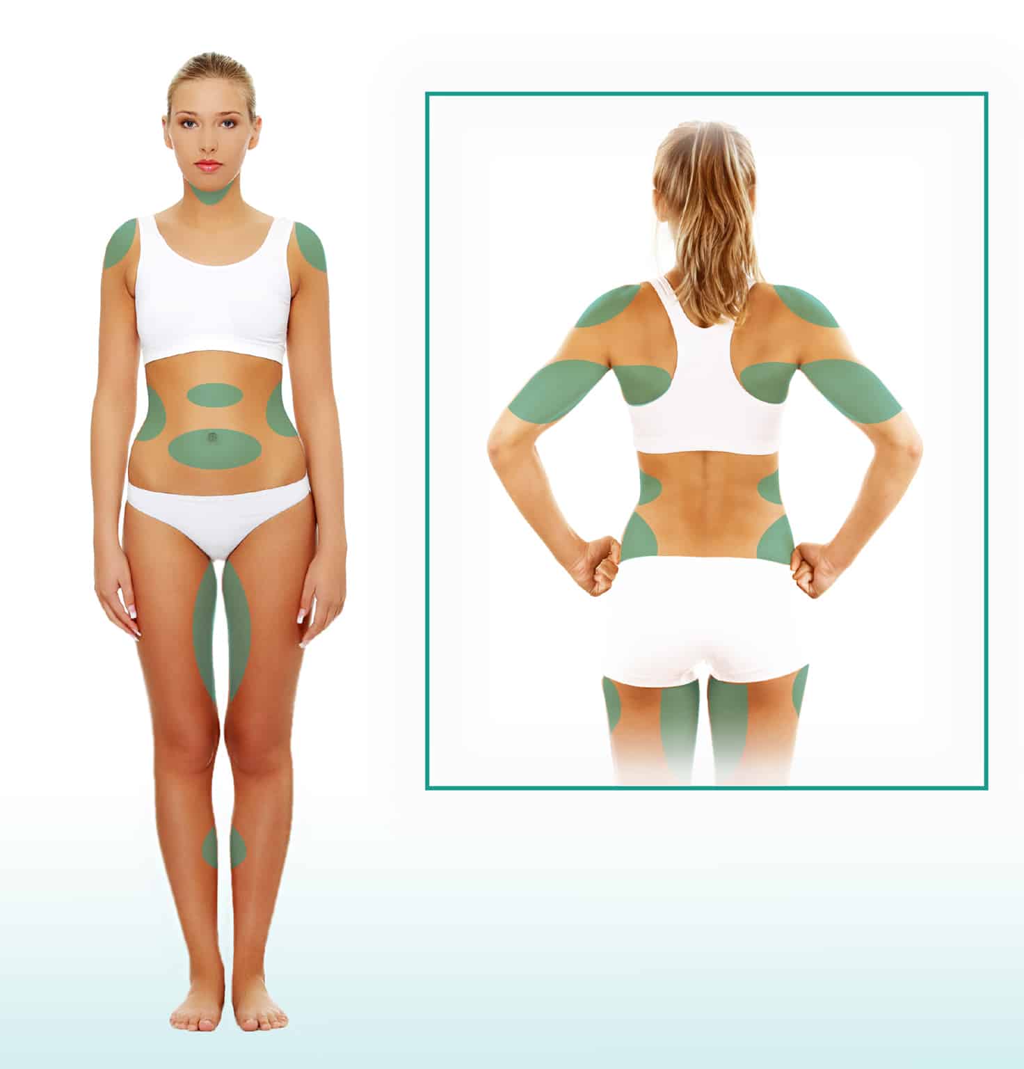 🥇 The Art of Body Contouring: Abdominal Liposuction as an Art