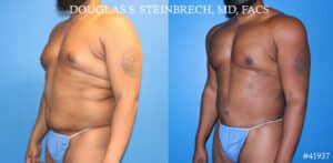 image of cosmetic plastic surgery results in NY, NY