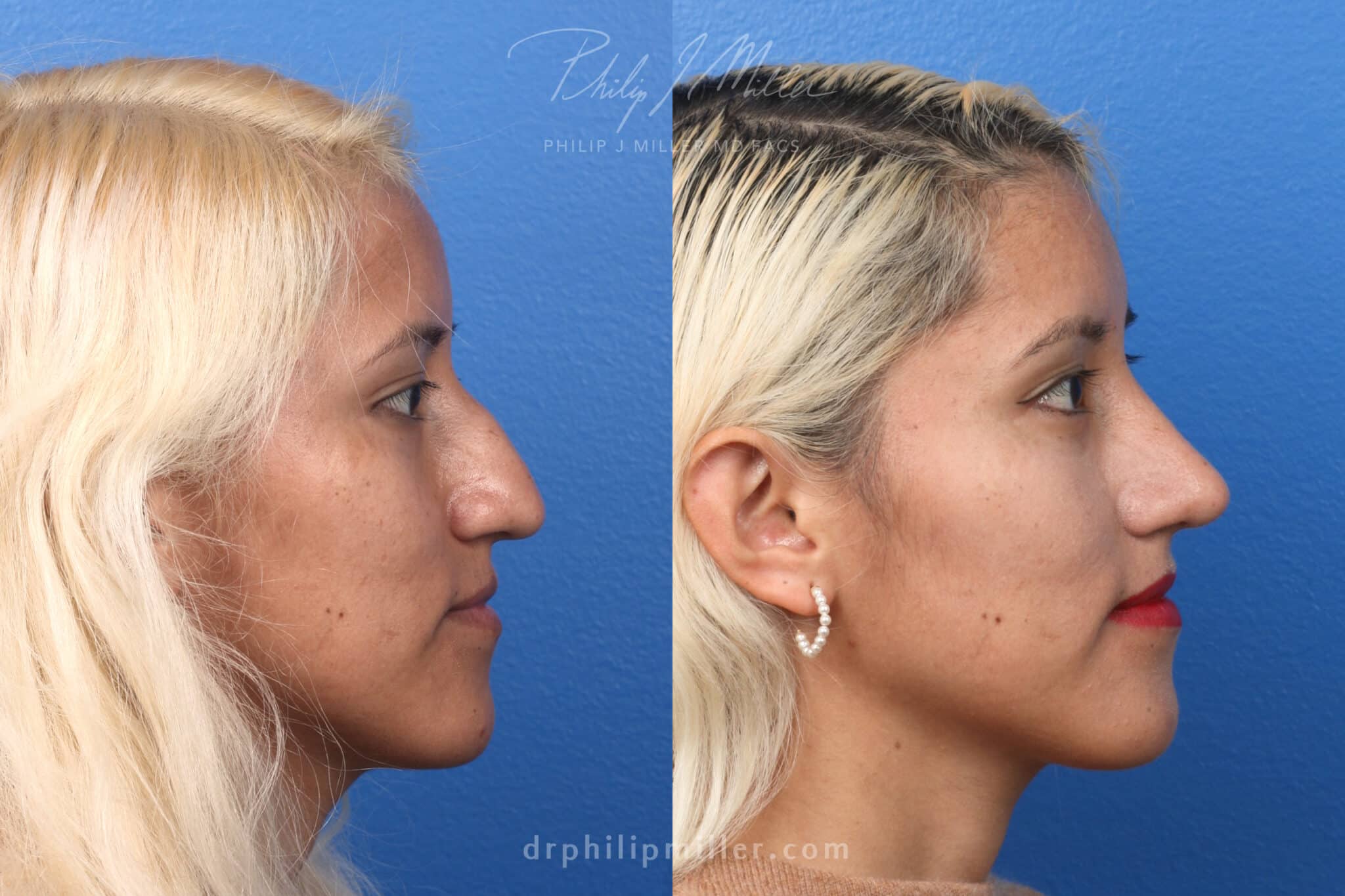 Pj fleck plastic surgery